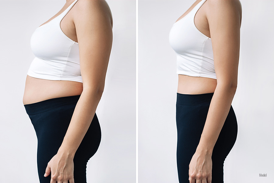 Before and after profile photo of a woman in a white top and black pants after losing weight.